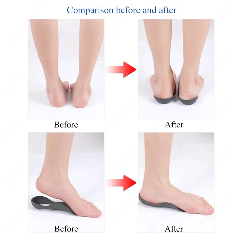 Orthotics Support Insole